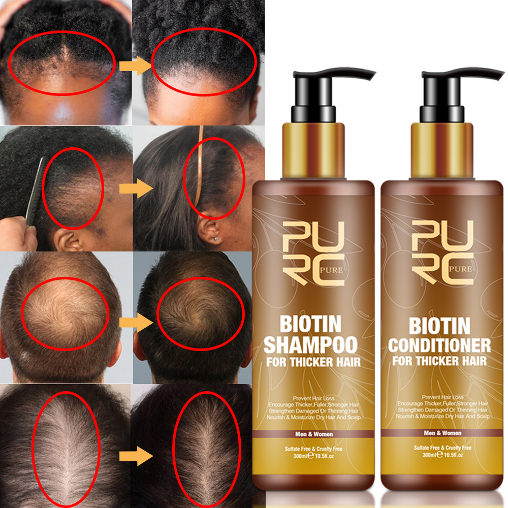 Biotin Hair Growth - PURC Smoothing Hair Scalp Treatment Hair